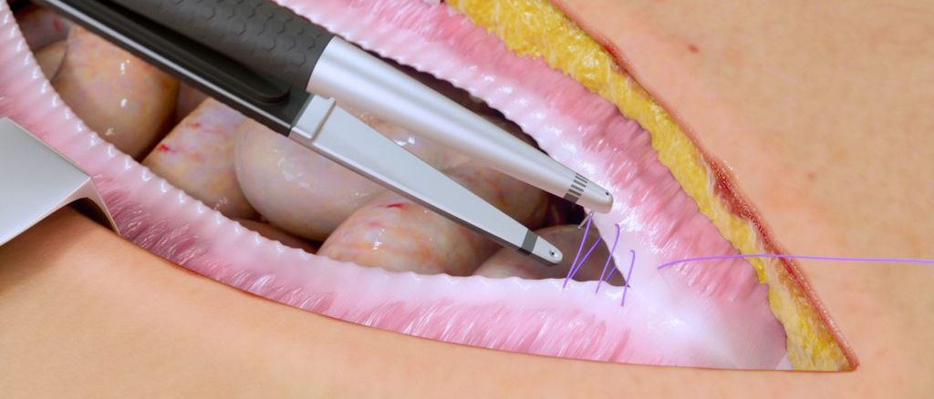 Mellon-switch-tool-in-use